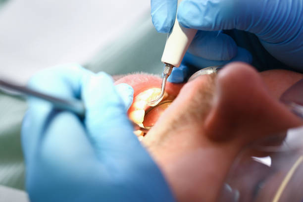 Best Emergency Treatment for Toothache in Fayetteville, GA