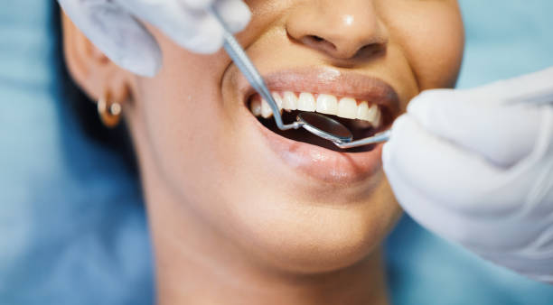 Best Weekend Emergency Dentist in Fayetteville, GA