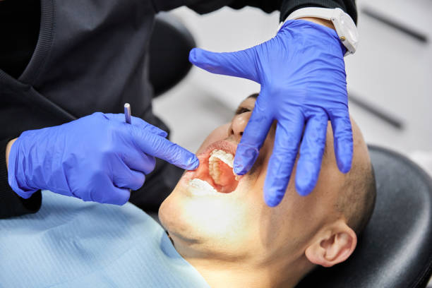 Best Emergency Broken Tooth Repair in Fayetteville, GA