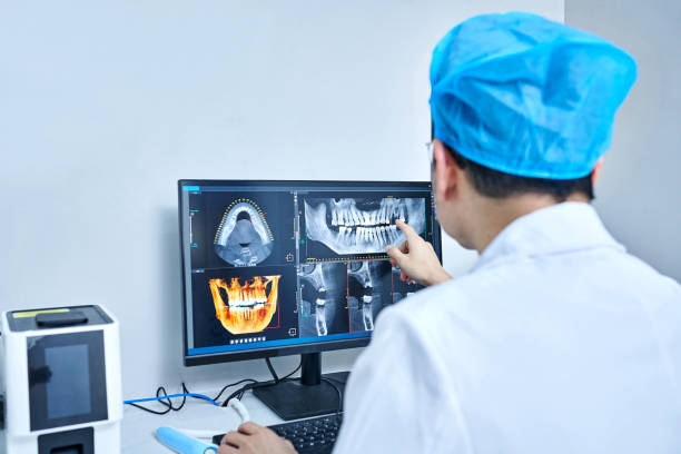 Best Emergency Tooth Extraction in Fayetteville, GA